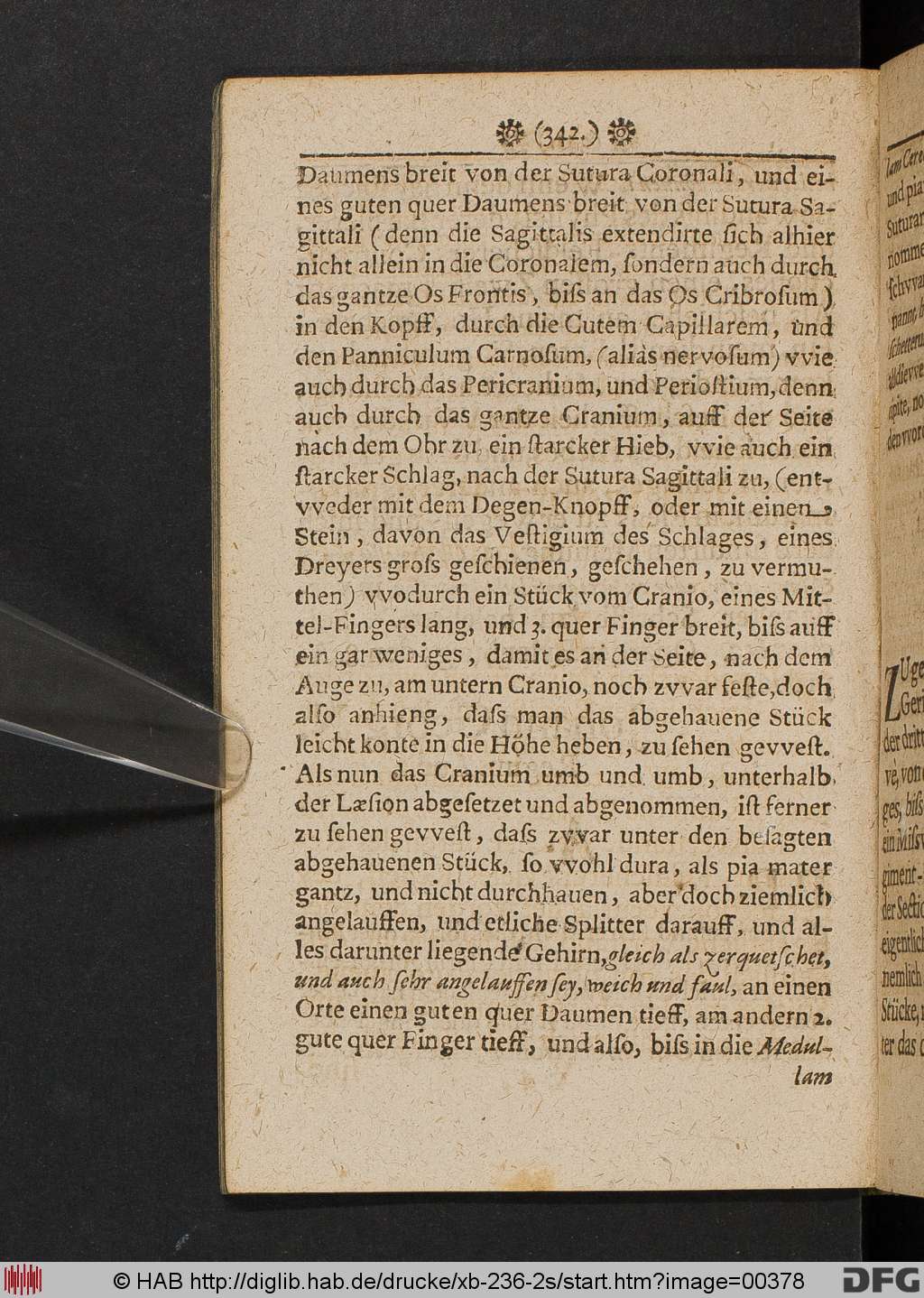 http://diglib.hab.de/drucke/xb-236-2s/00378.jpg