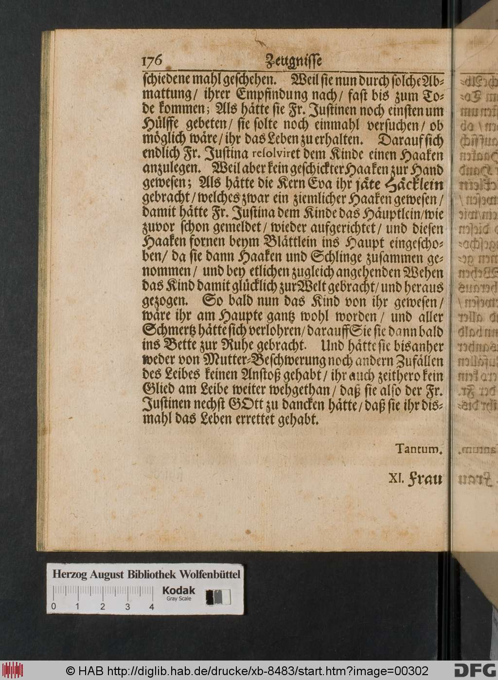 http://diglib.hab.de/drucke/xb-8483/00302.jpg