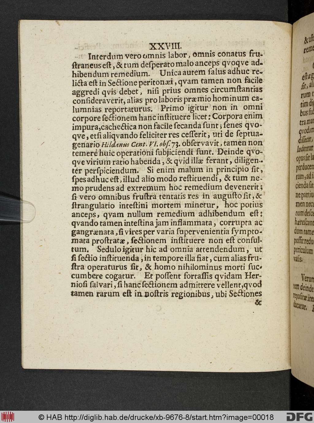 http://diglib.hab.de/drucke/xb-9676-8/00018.jpg