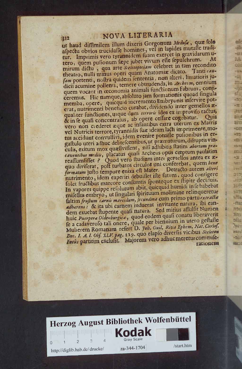 http://diglib.hab.de/drucke/za-344-1704/00314.jpg
