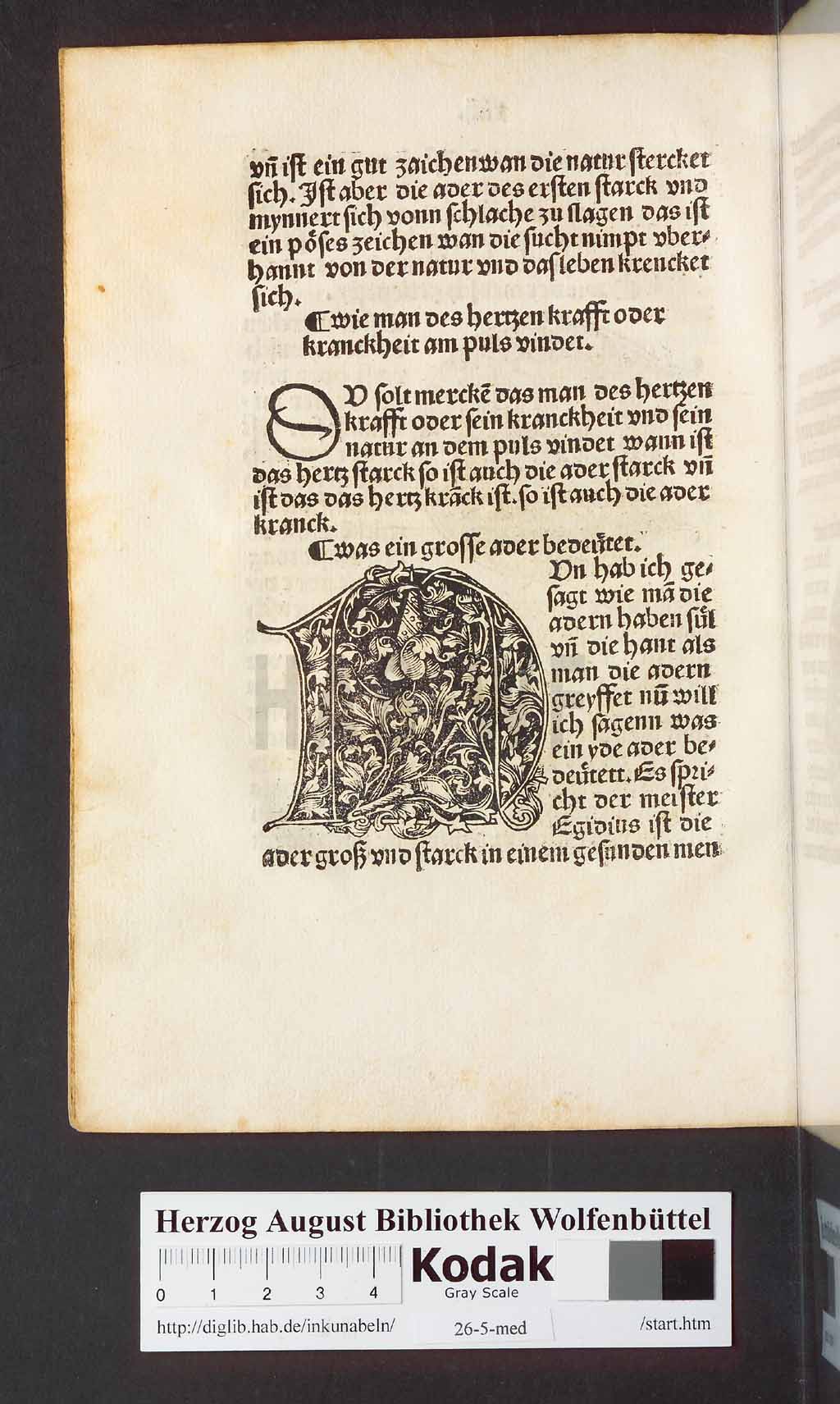 http://diglib.hab.de/inkunabeln/26-5-med/00032.jpg