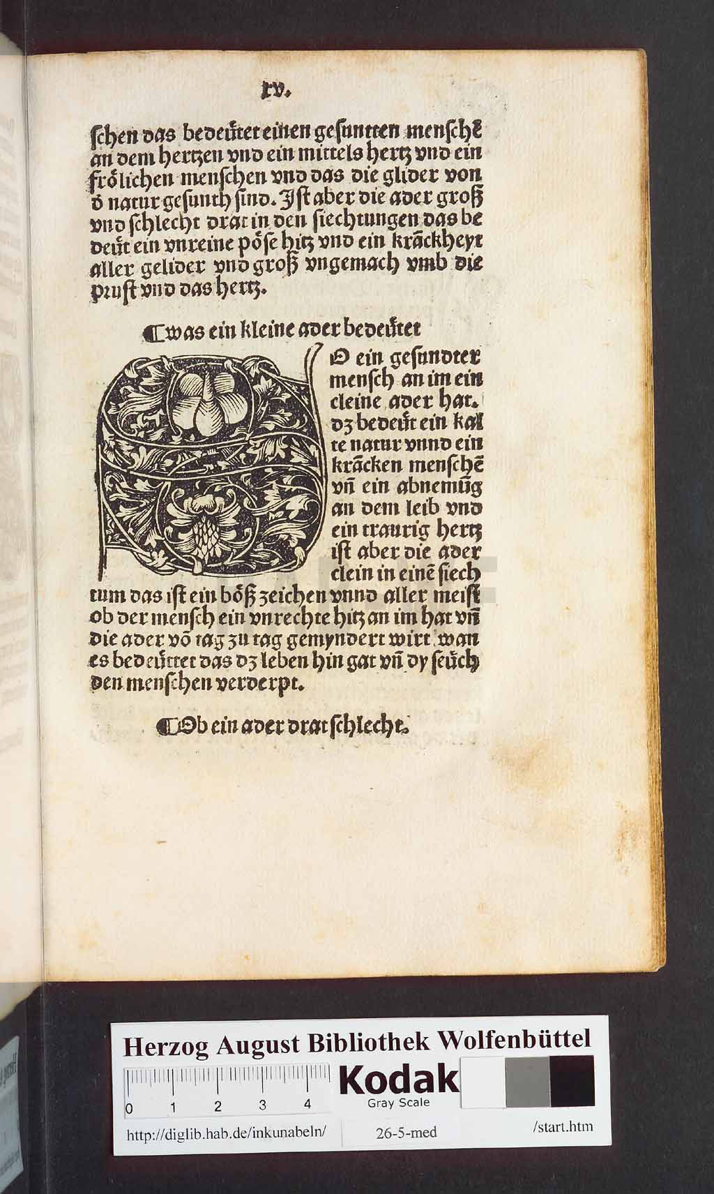 http://diglib.hab.de/inkunabeln/26-5-med/00033.jpg