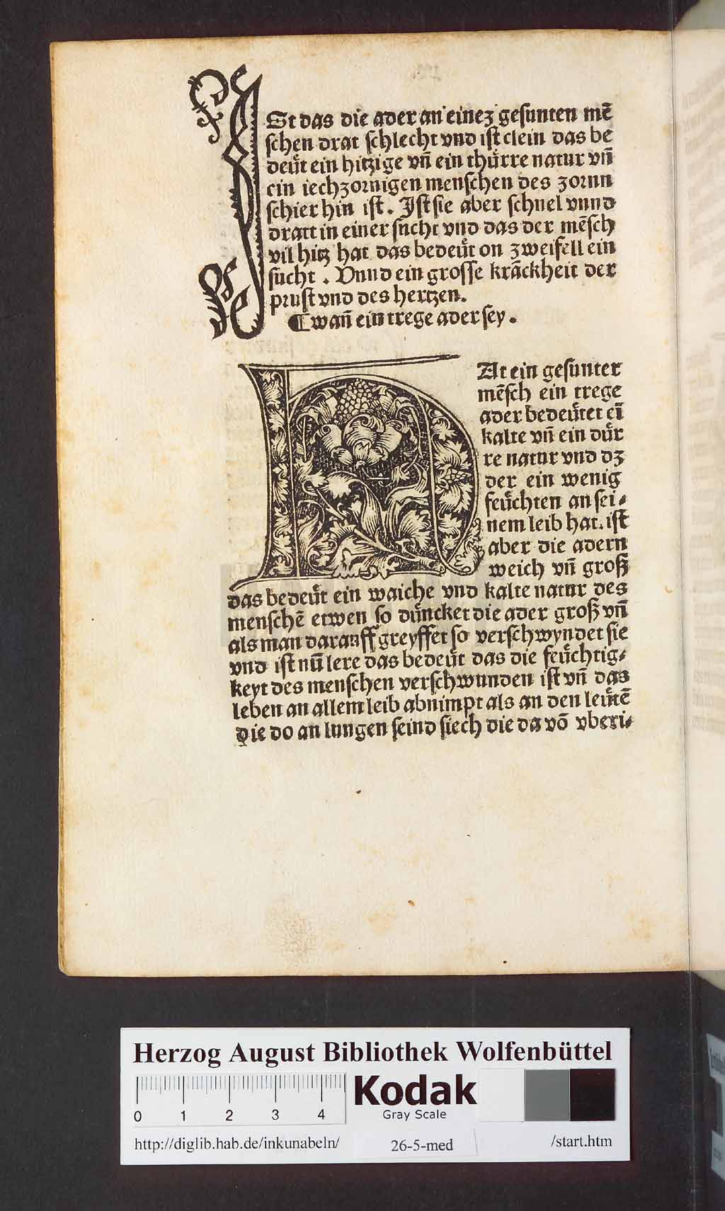 http://diglib.hab.de/inkunabeln/26-5-med/00034.jpg