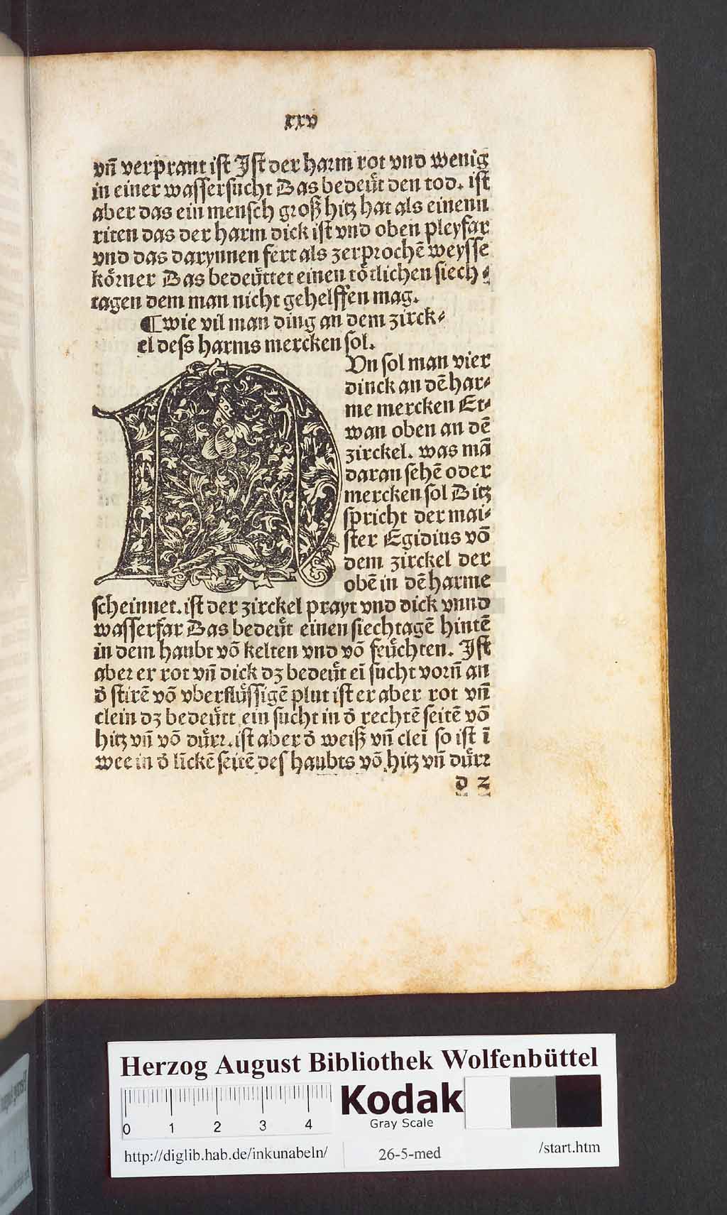 http://diglib.hab.de/inkunabeln/26-5-med/00053.jpg