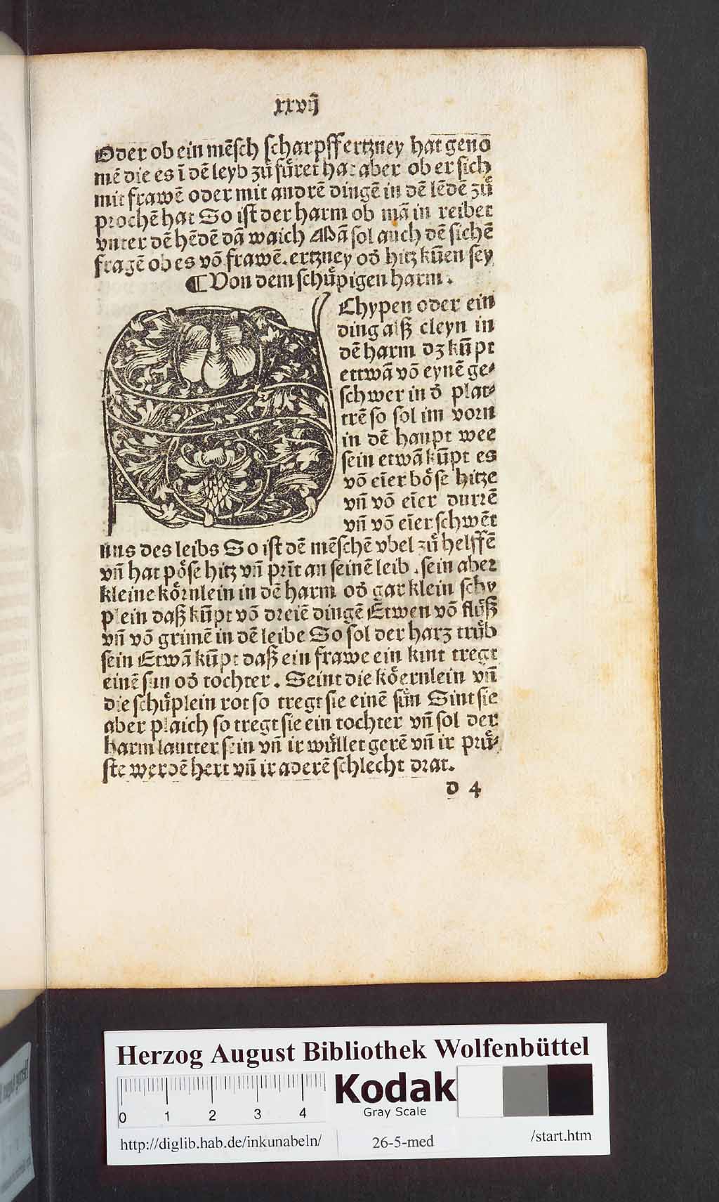 http://diglib.hab.de/inkunabeln/26-5-med/00057.jpg