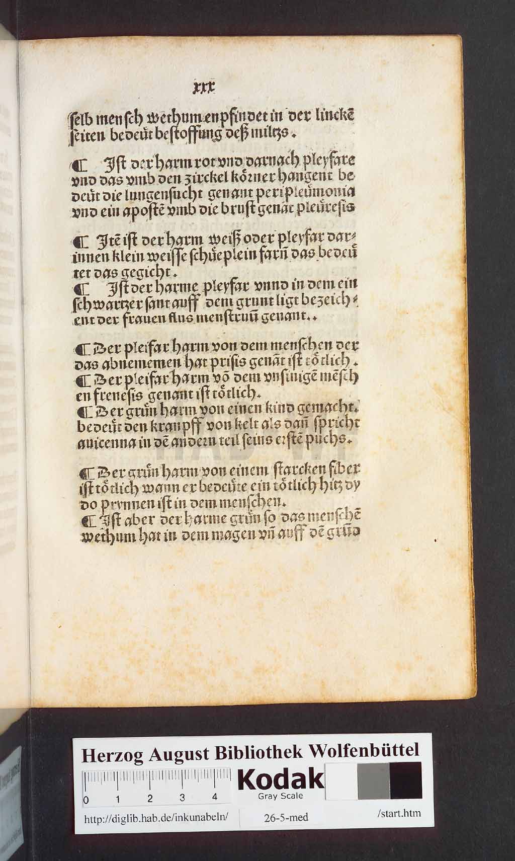 http://diglib.hab.de/inkunabeln/26-5-med/00063.jpg