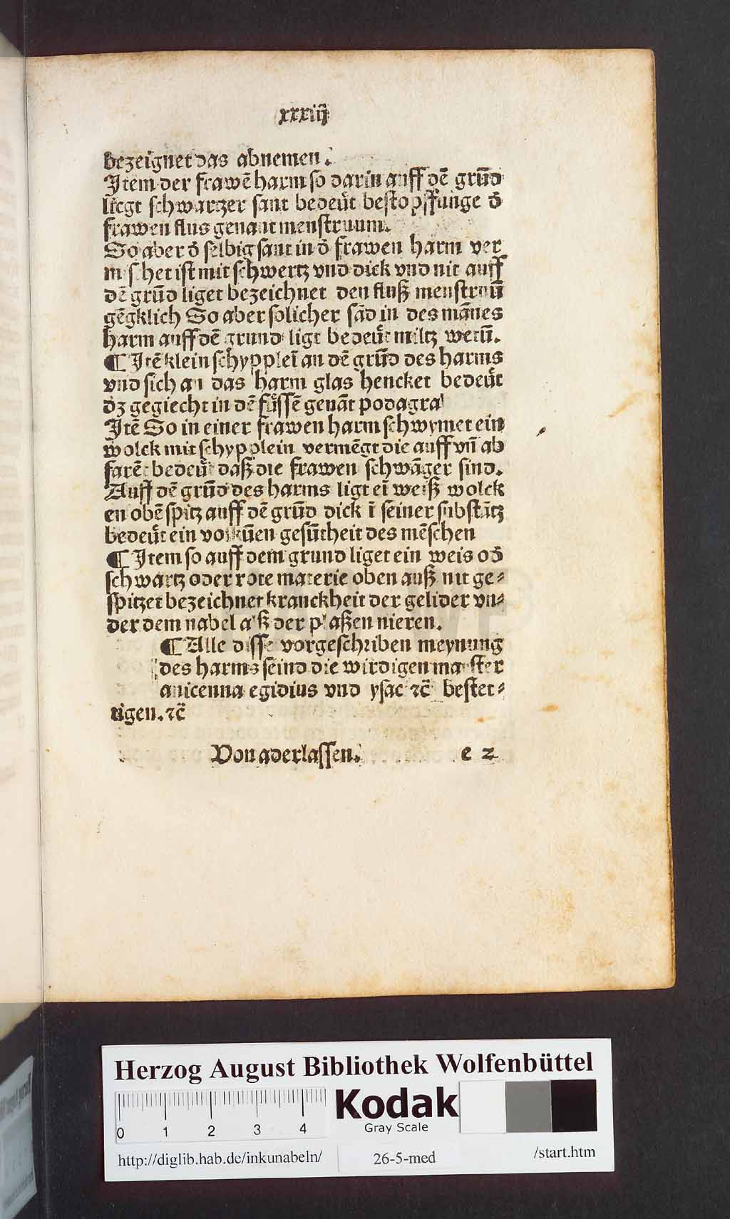 http://diglib.hab.de/inkunabeln/26-5-med/00069.jpg