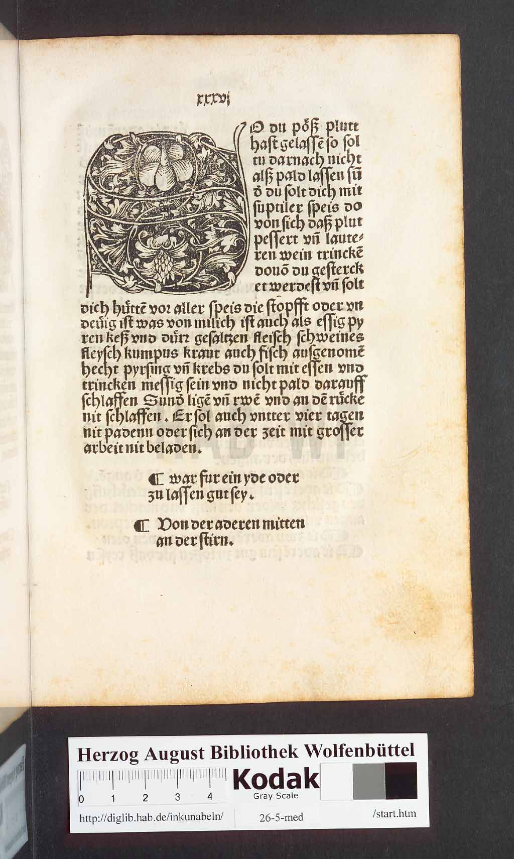 http://diglib.hab.de/inkunabeln/26-5-med/00075.jpg