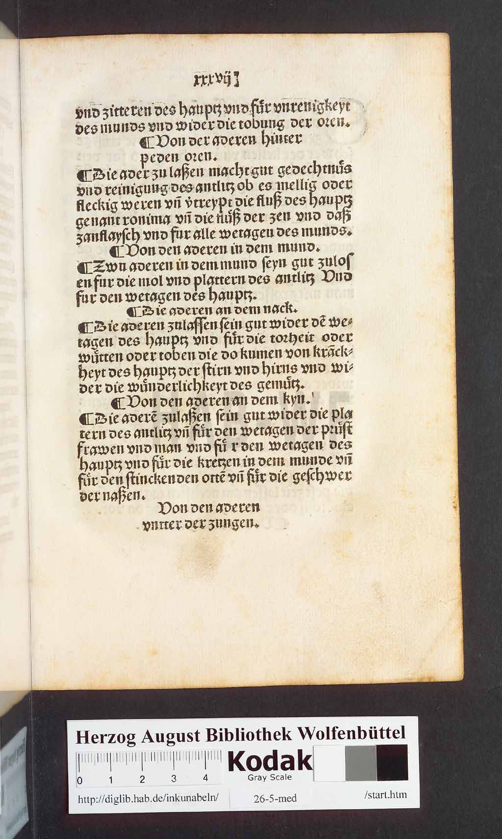 http://diglib.hab.de/inkunabeln/26-5-med/00077.jpg
