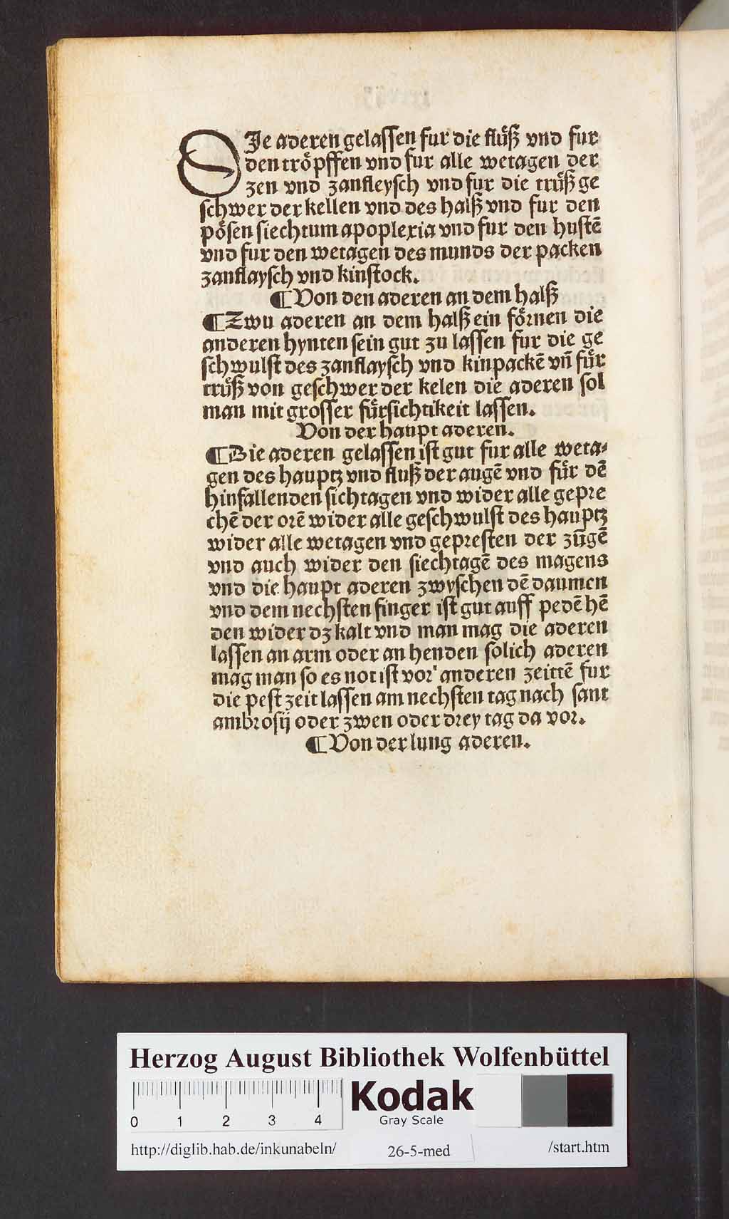http://diglib.hab.de/inkunabeln/26-5-med/00078.jpg