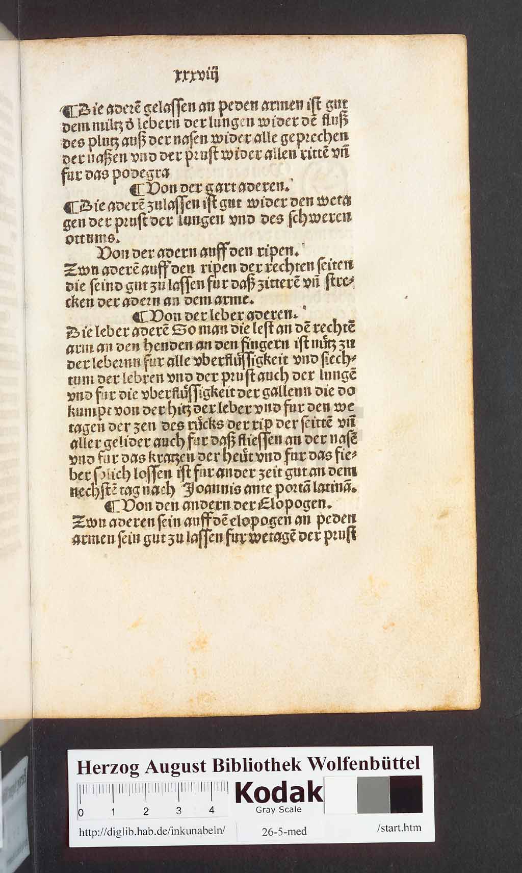 http://diglib.hab.de/inkunabeln/26-5-med/00079.jpg