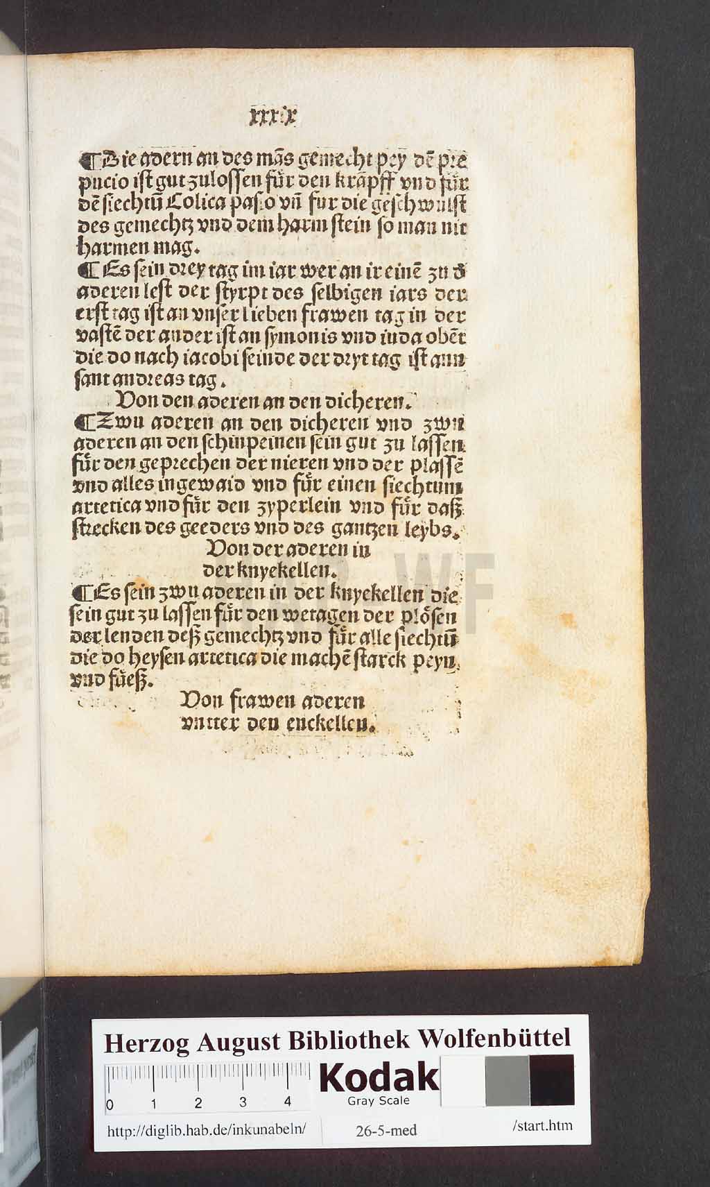 http://diglib.hab.de/inkunabeln/26-5-med/00081.jpg