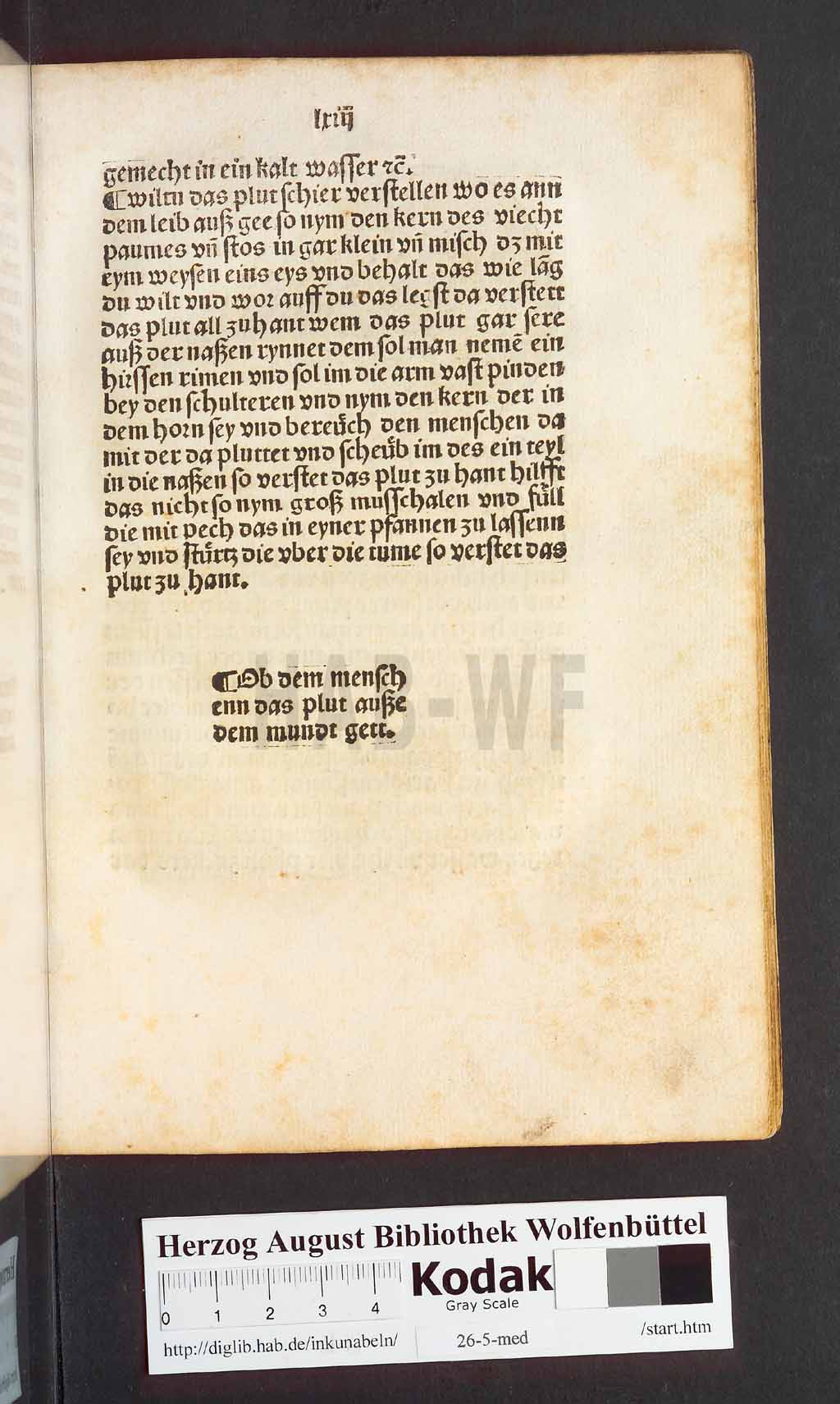 http://diglib.hab.de/inkunabeln/26-5-med/00129.jpg