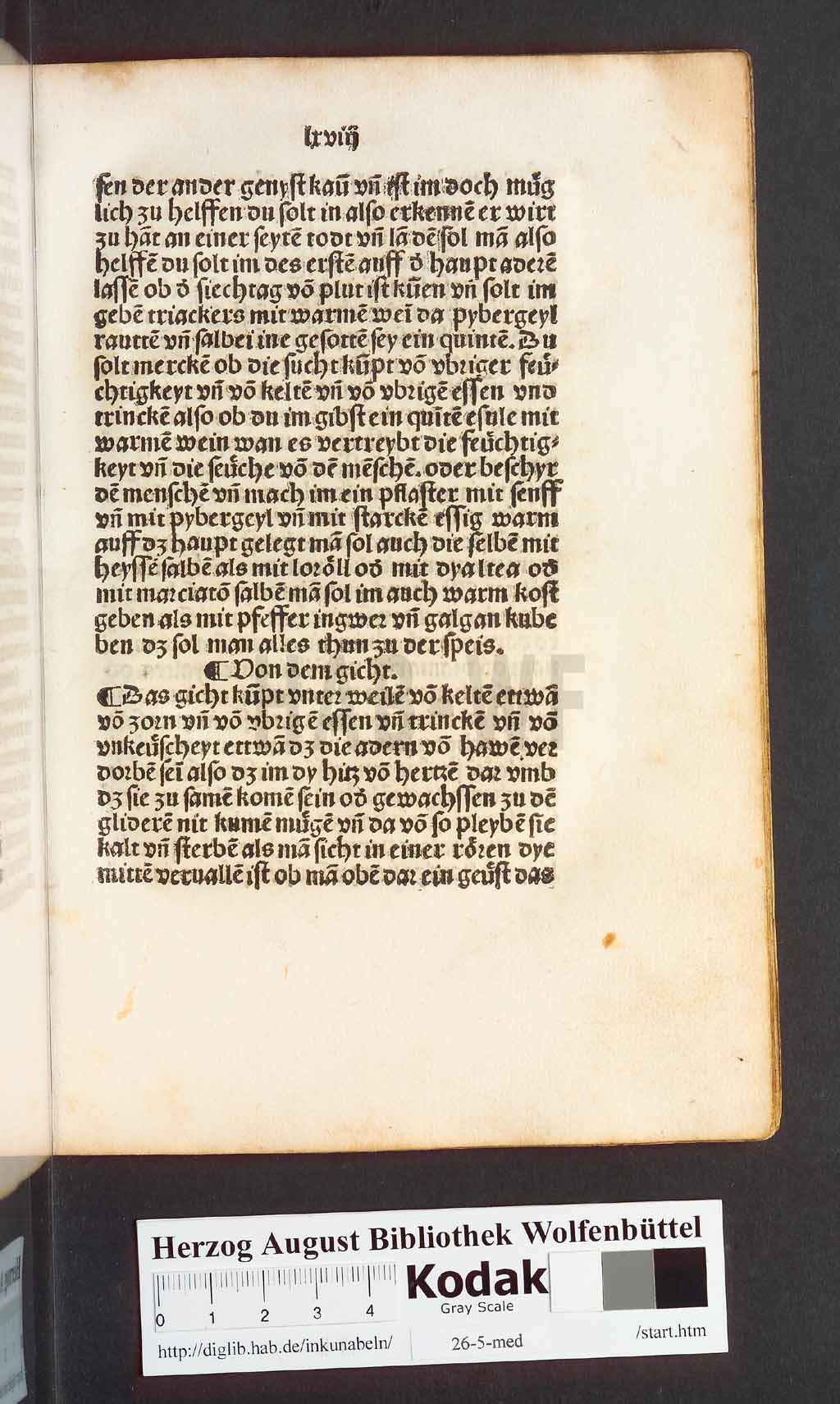 http://diglib.hab.de/inkunabeln/26-5-med/00139.jpg