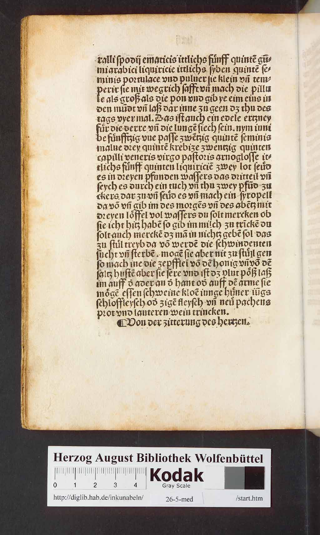 http://diglib.hab.de/inkunabeln/26-5-med/00148.jpg