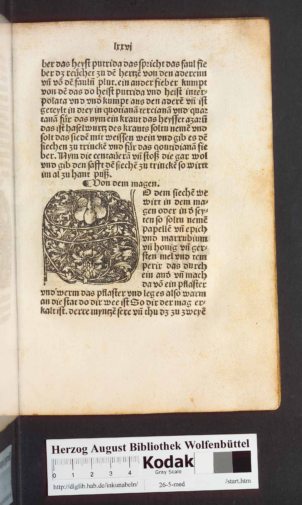 http://diglib.hab.de/inkunabeln/26-5-med/00155.jpg