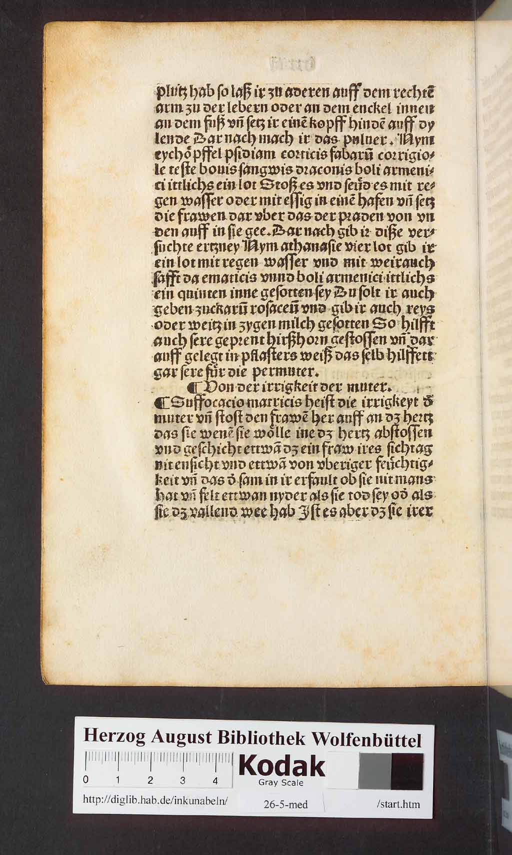 http://diglib.hab.de/inkunabeln/26-5-med/00172.jpg