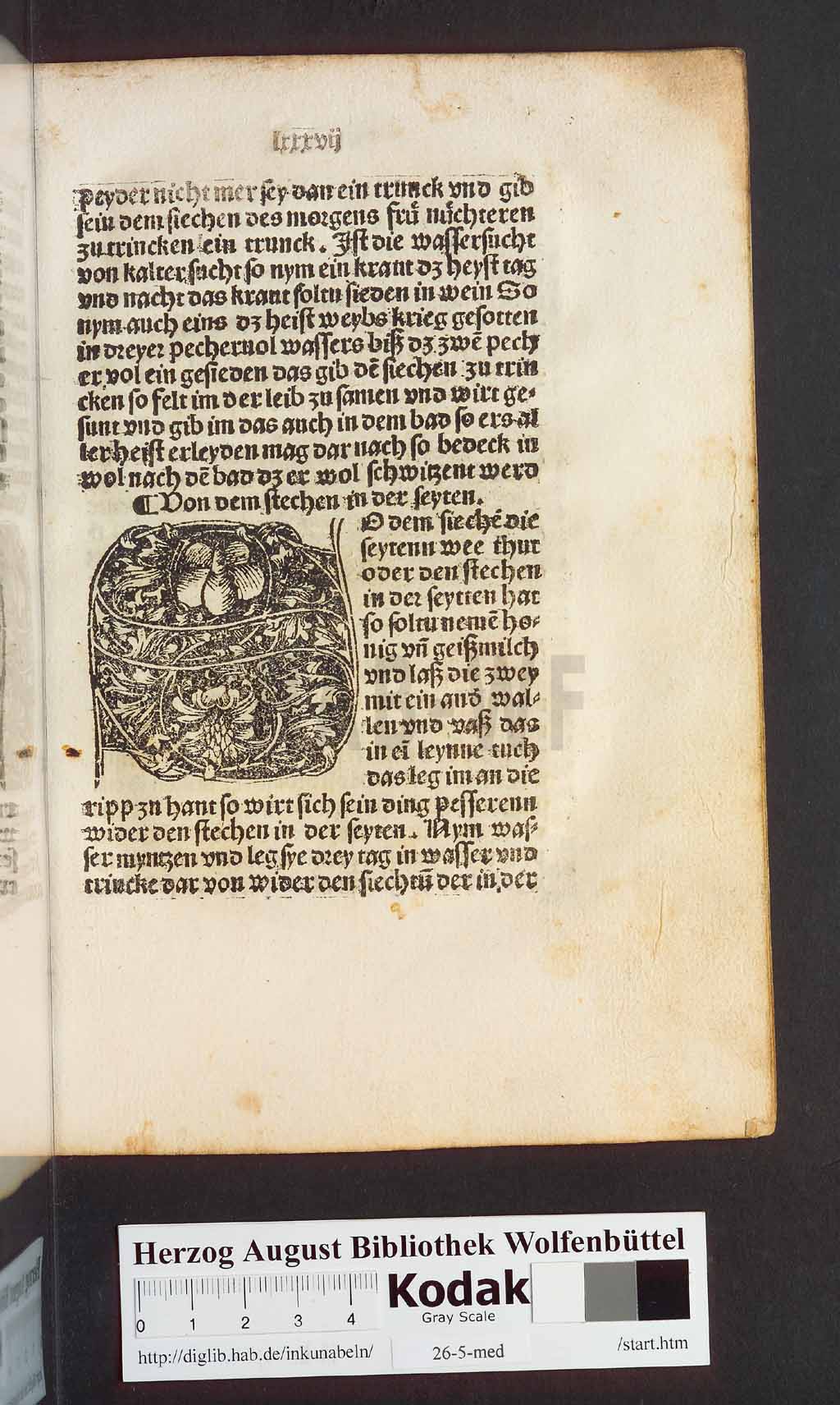 http://diglib.hab.de/inkunabeln/26-5-med/00177.jpg