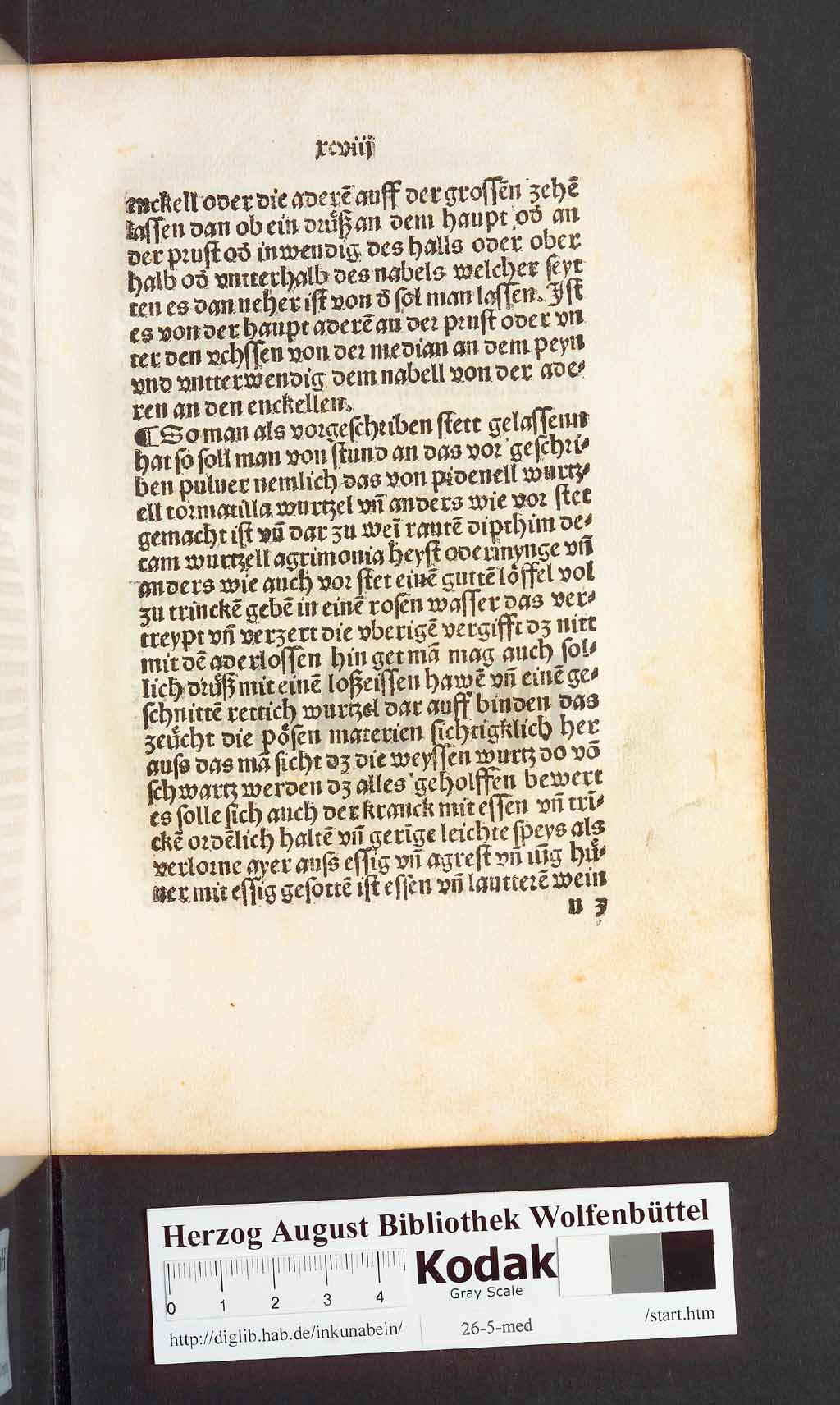 http://diglib.hab.de/inkunabeln/26-5-med/00199.jpg
