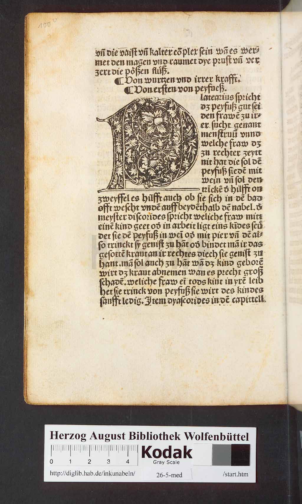 http://diglib.hab.de/inkunabeln/26-5-med/00204.jpg