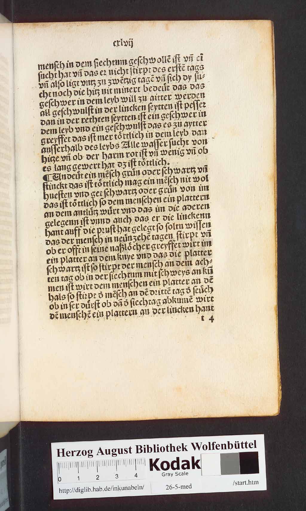 http://diglib.hab.de/inkunabeln/26-5-med/00297.jpg