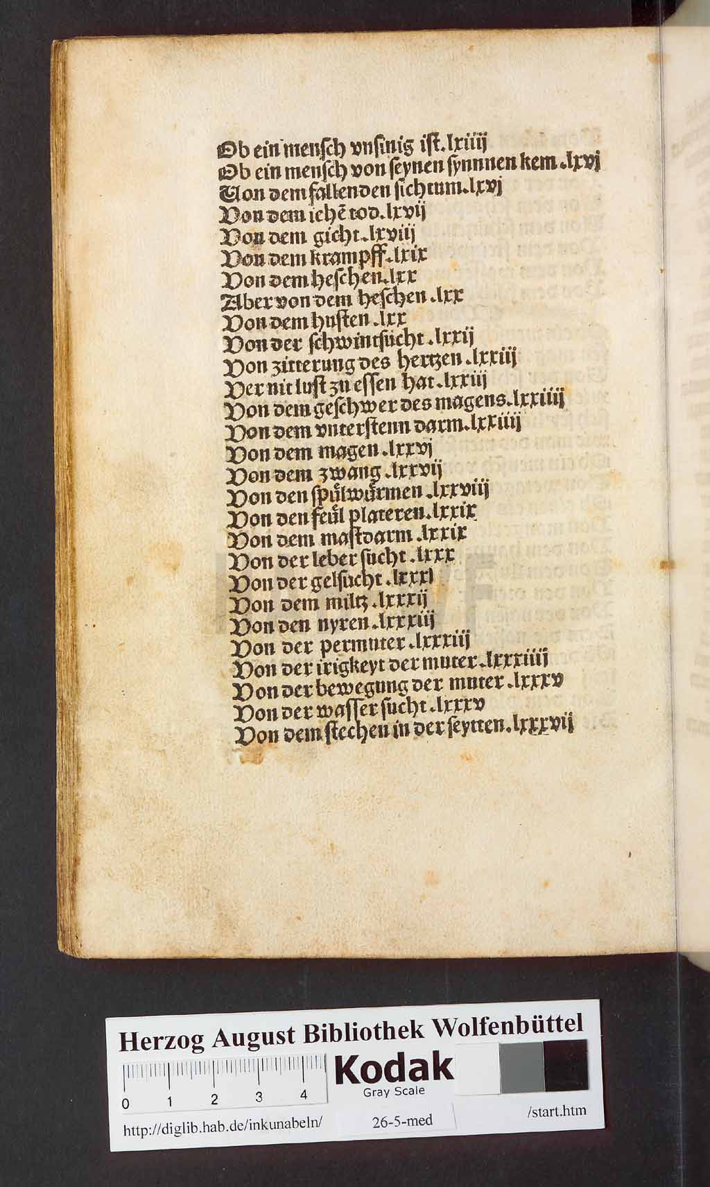 http://diglib.hab.de/inkunabeln/26-5-med/00356.jpg