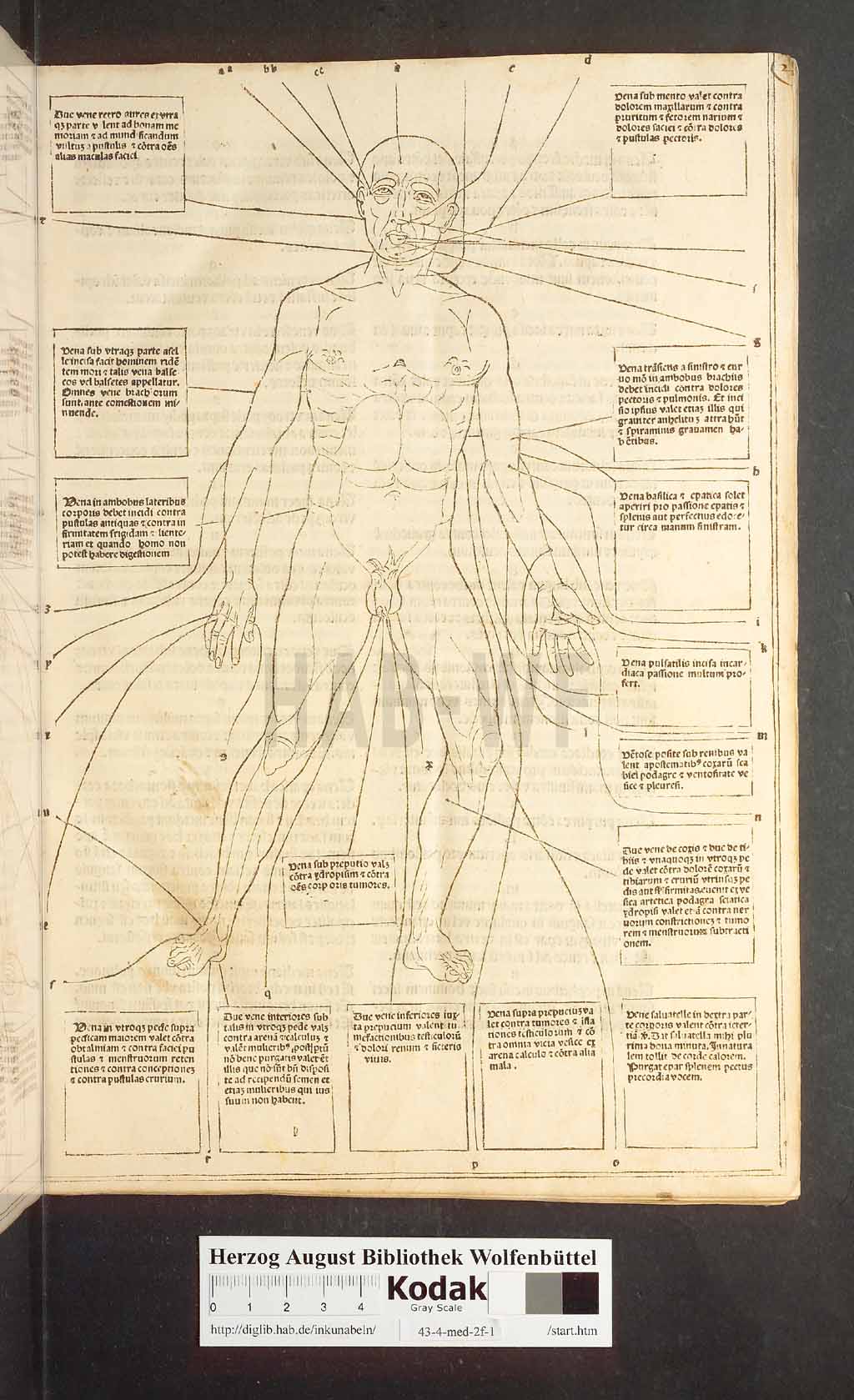 http://diglib.hab.de/inkunabeln/43-4-med-2f-1/00009.jpg