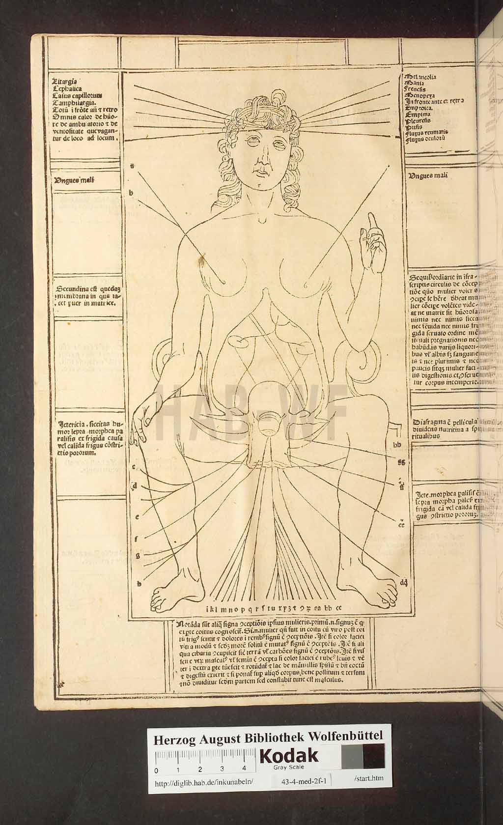 http://diglib.hab.de/inkunabeln/43-4-med-2f-1/00018.jpg