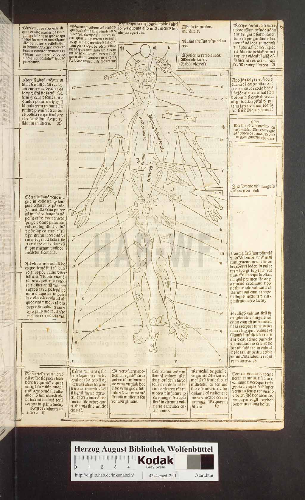 http://diglib.hab.de/inkunabeln/43-4-med-2f-1/00029.jpg