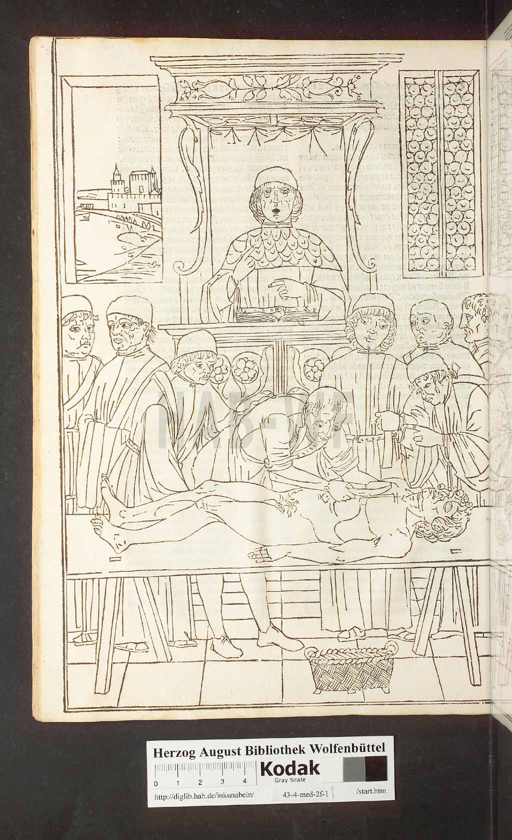 http://diglib.hab.de/inkunabeln/43-4-med-2f-1/00054.jpg
