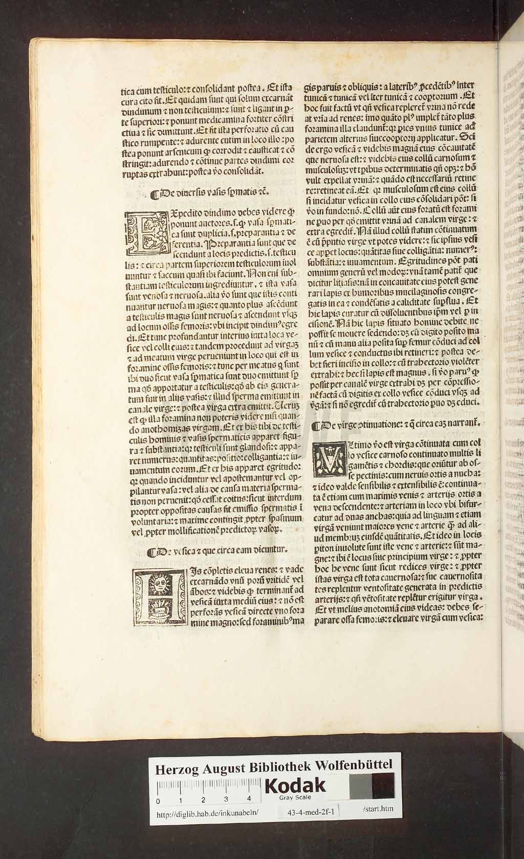 http://diglib.hab.de/inkunabeln/43-4-med-2f-1/00068.jpg