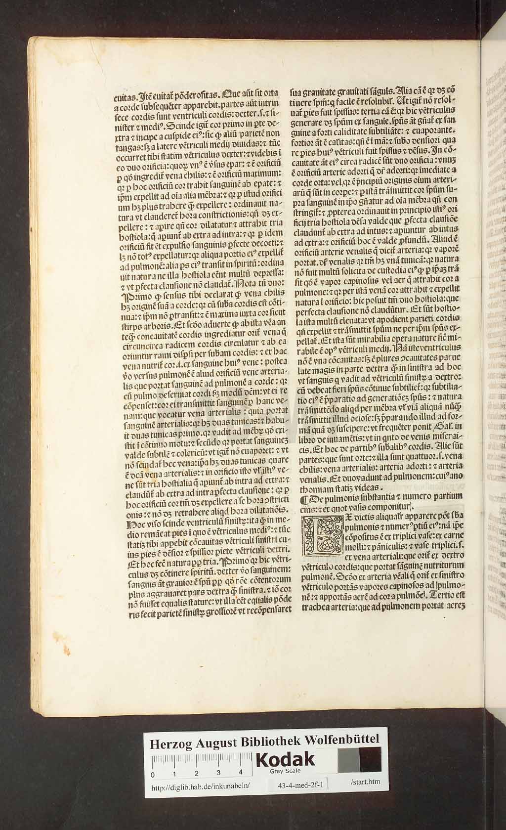 http://diglib.hab.de/inkunabeln/43-4-med-2f-1/00072.jpg
