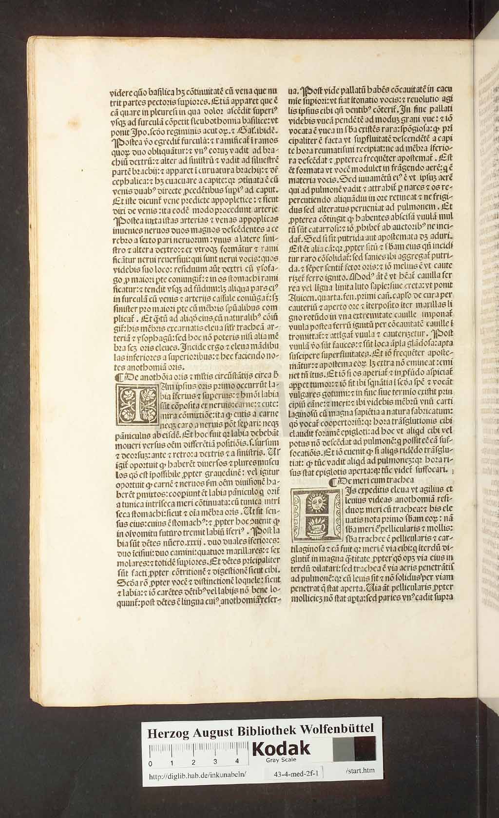 http://diglib.hab.de/inkunabeln/43-4-med-2f-1/00074.jpg