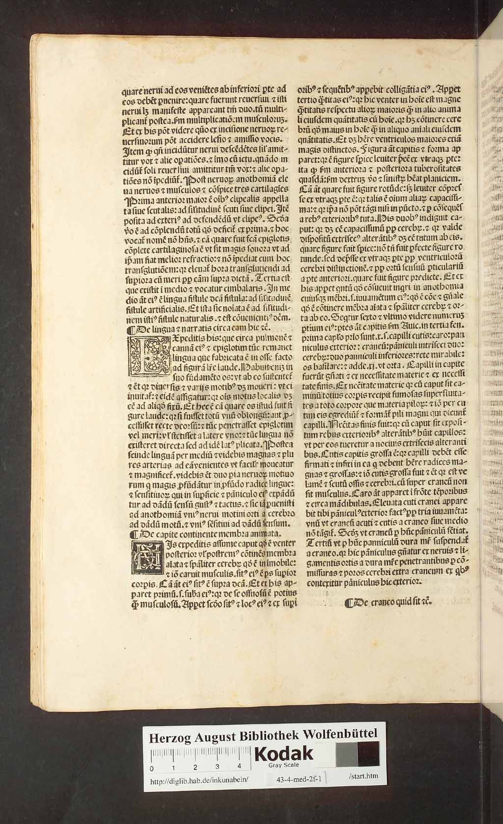 http://diglib.hab.de/inkunabeln/43-4-med-2f-1/00076.jpg