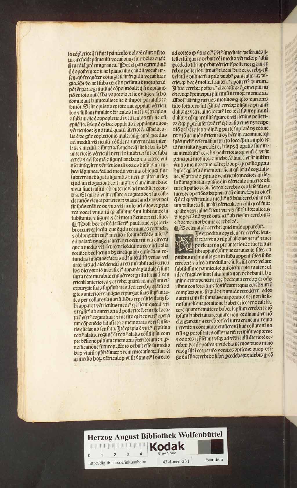 http://diglib.hab.de/inkunabeln/43-4-med-2f-1/00078.jpg