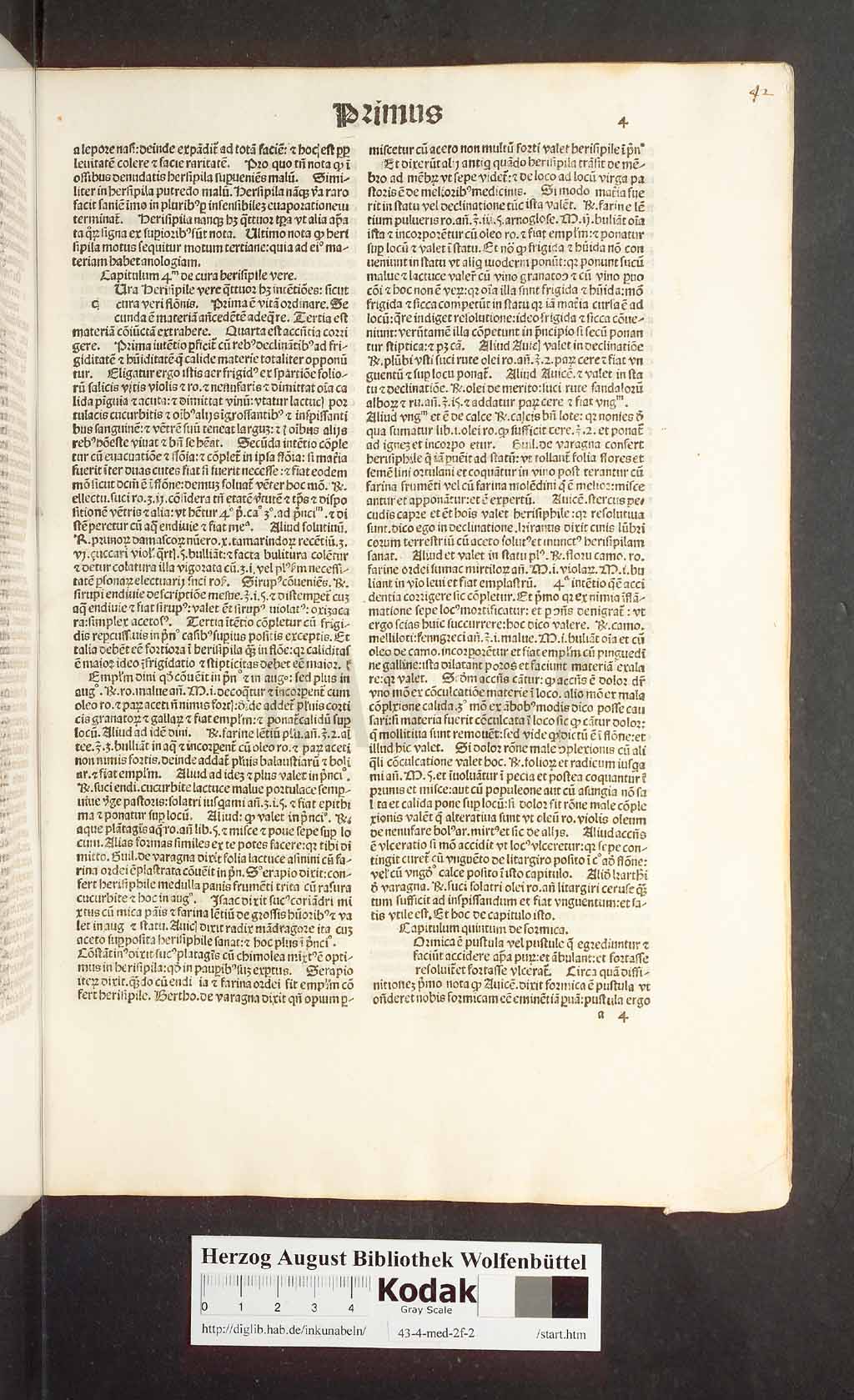 http://diglib.hab.de/inkunabeln/43-4-med-2f-2/00007.jpg