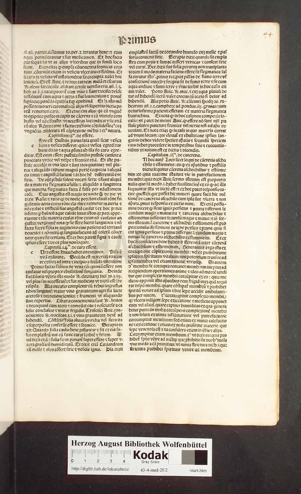 http://diglib.hab.de/inkunabeln/43-4-med-2f-2/00011.jpg