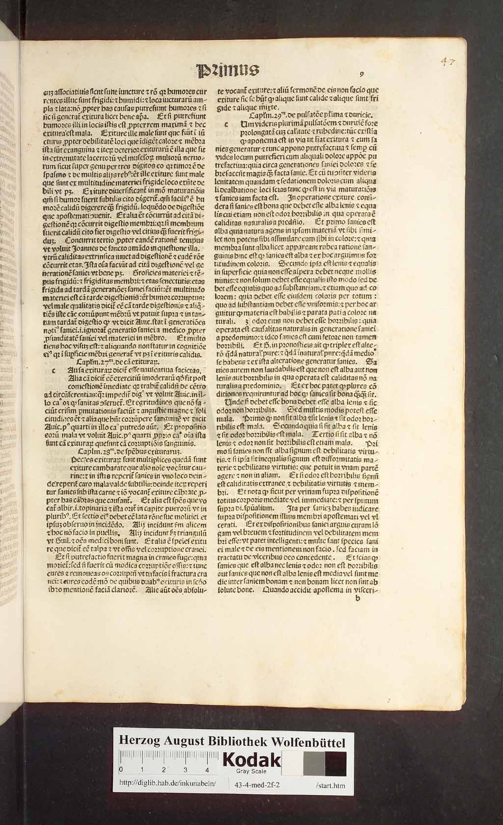 http://diglib.hab.de/inkunabeln/43-4-med-2f-2/00017.jpg