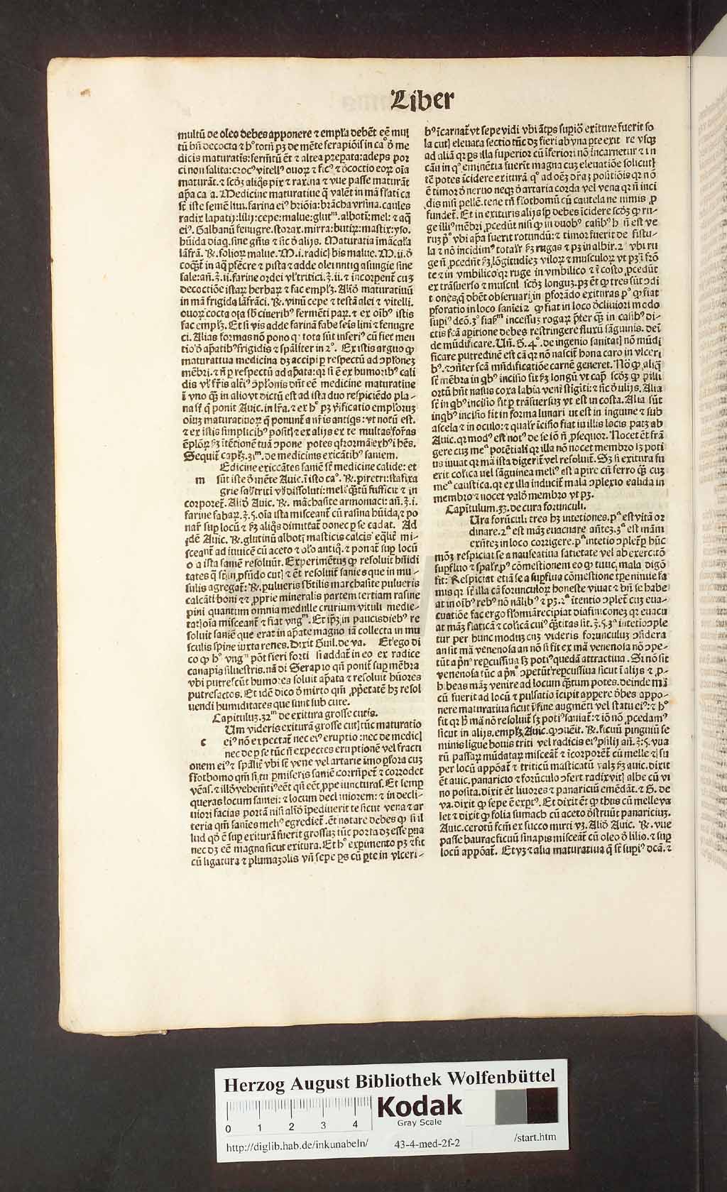 http://diglib.hab.de/inkunabeln/43-4-med-2f-2/00020.jpg