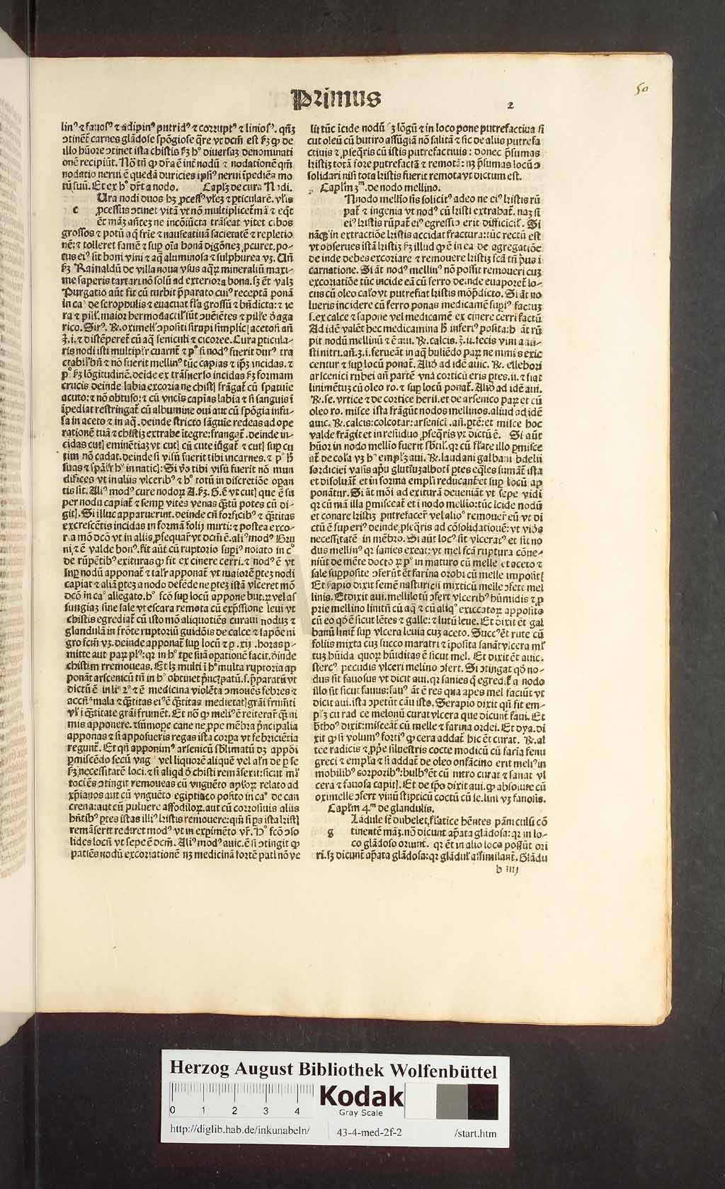 http://diglib.hab.de/inkunabeln/43-4-med-2f-2/00023.jpg