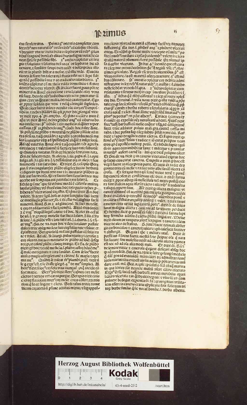 http://diglib.hab.de/inkunabeln/43-4-med-2f-2/00029.jpg