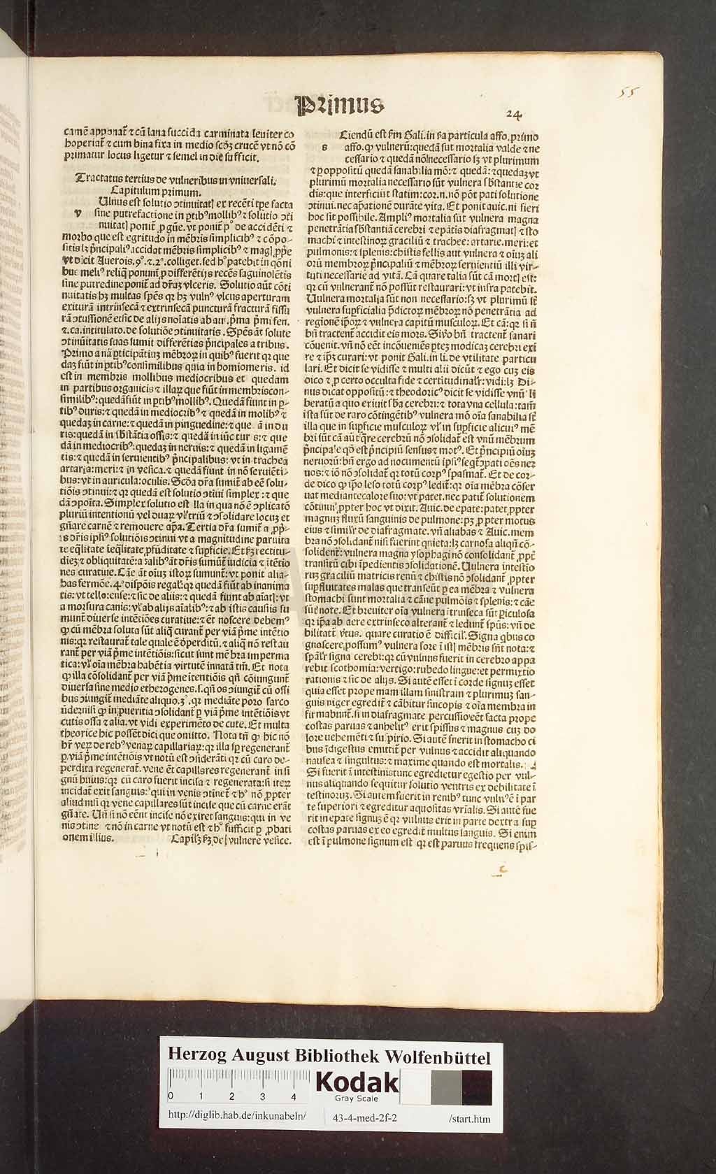 http://diglib.hab.de/inkunabeln/43-4-med-2f-2/00033.jpg