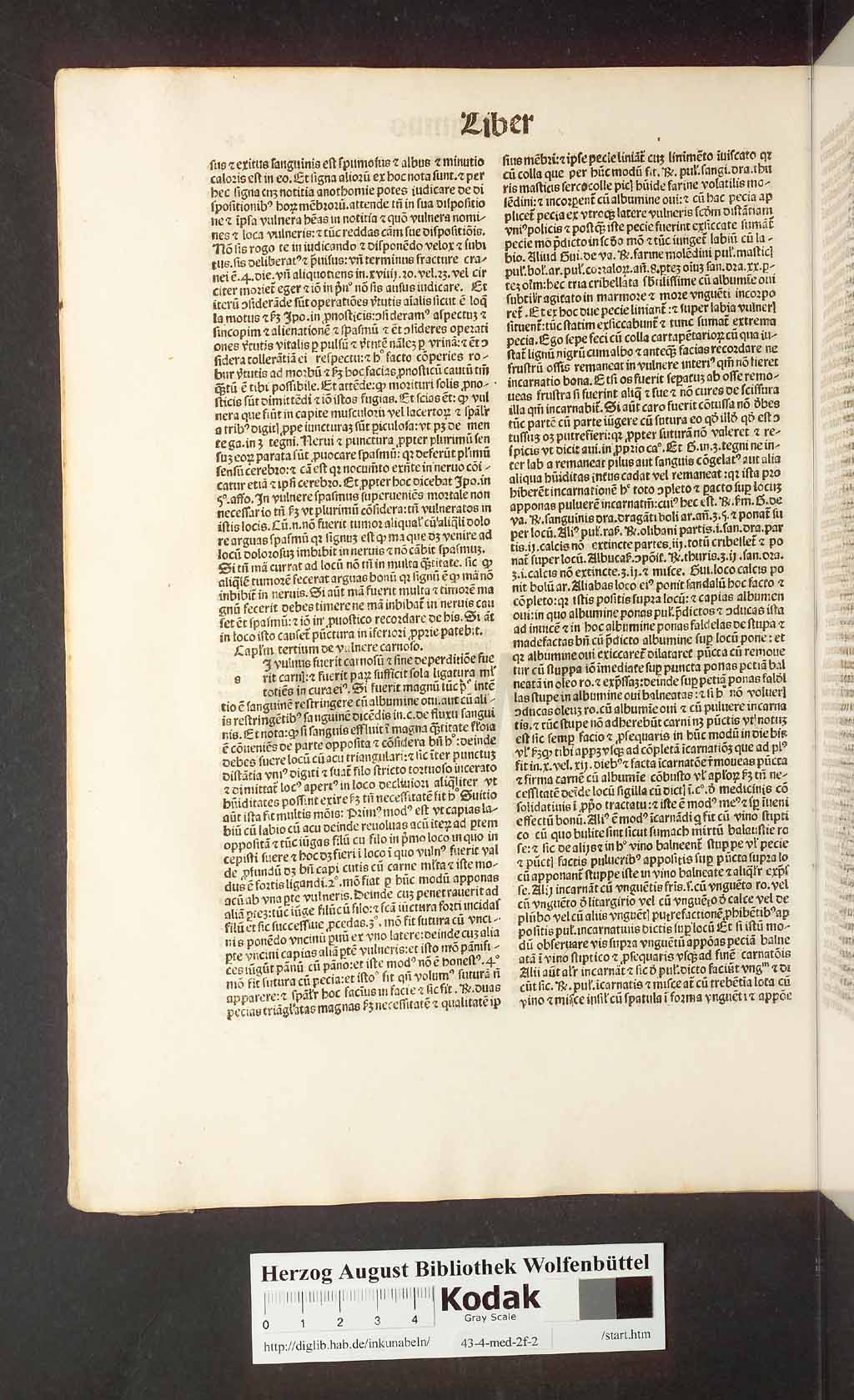 http://diglib.hab.de/inkunabeln/43-4-med-2f-2/00034.jpg