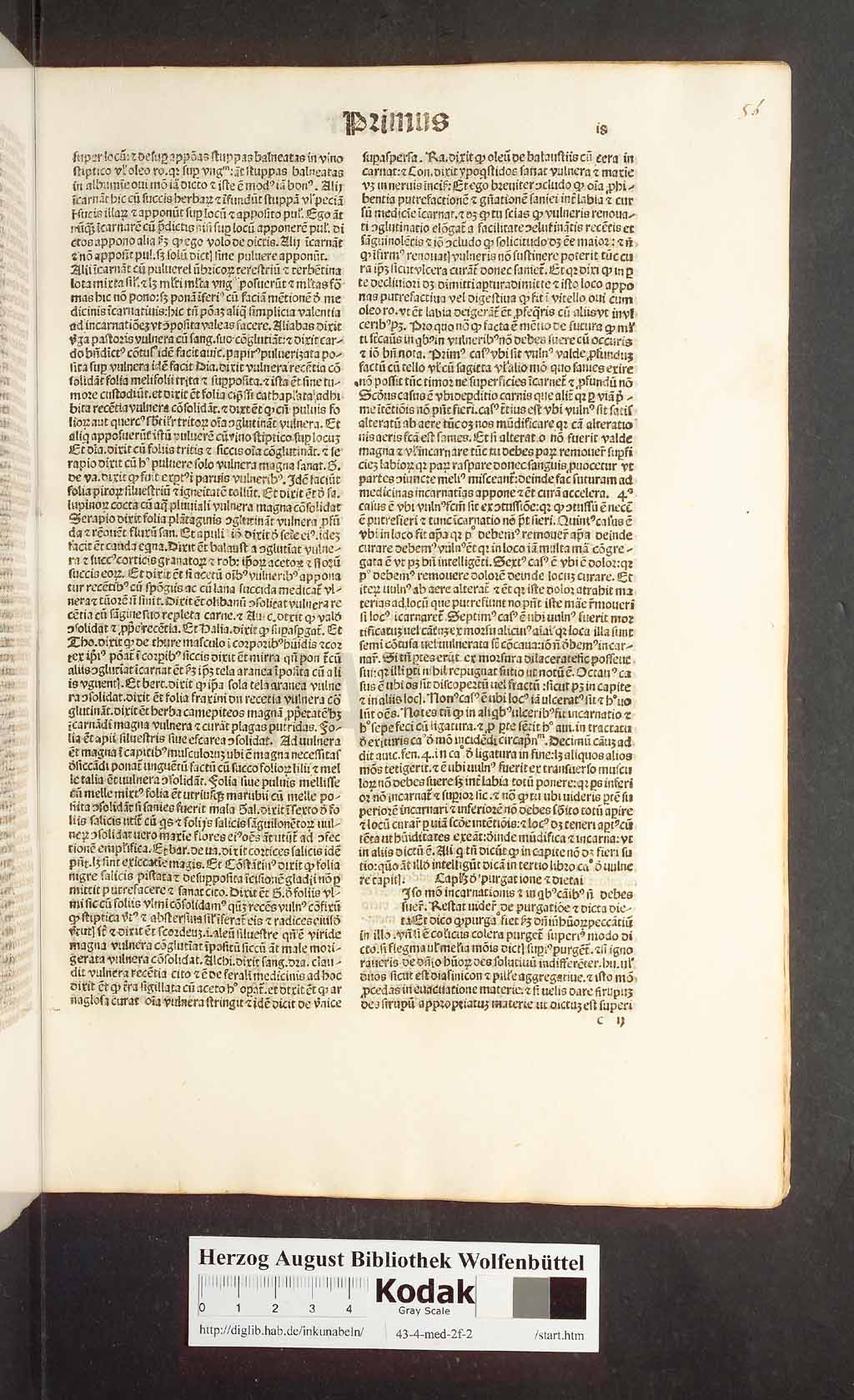 http://diglib.hab.de/inkunabeln/43-4-med-2f-2/00035.jpg