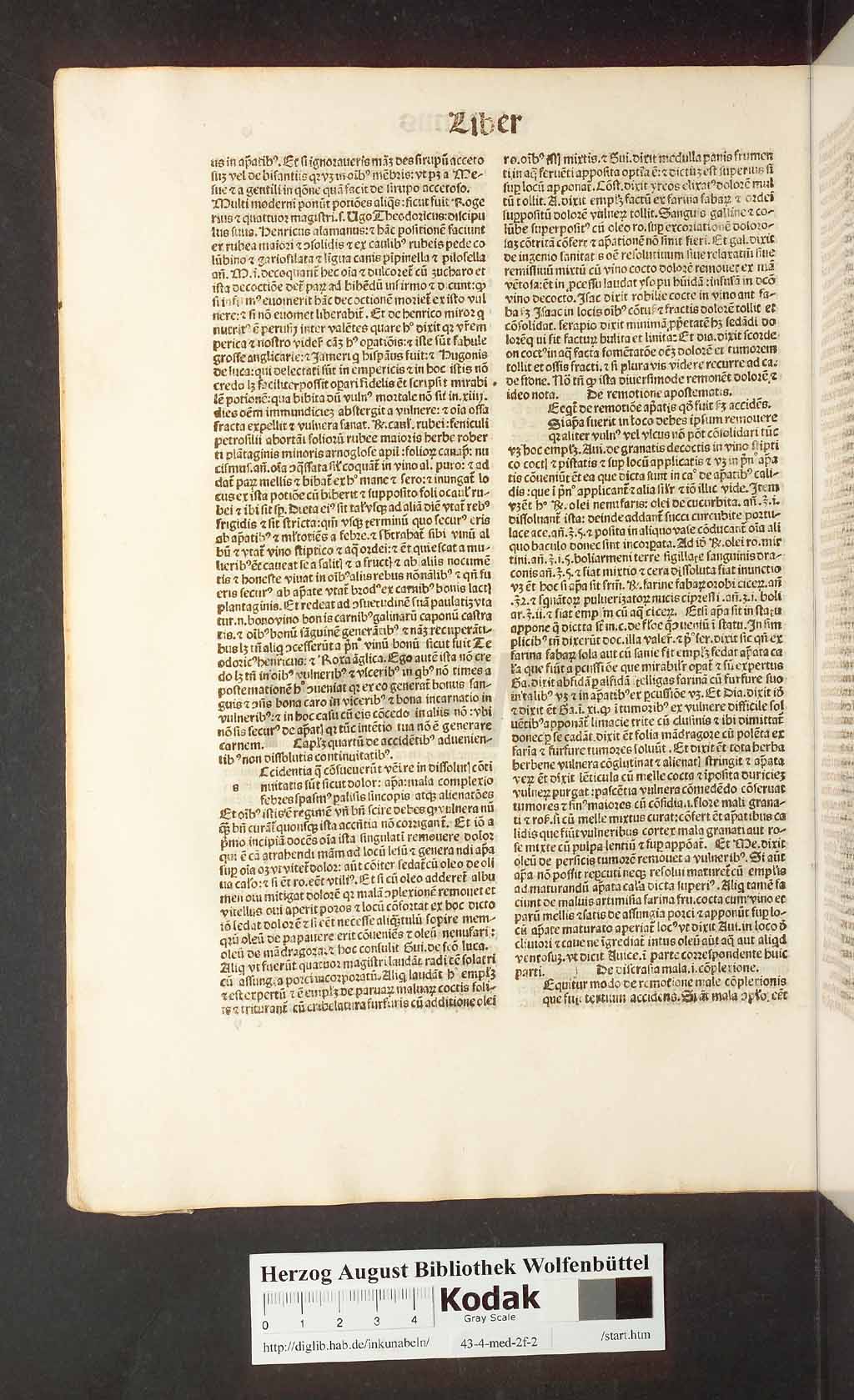 http://diglib.hab.de/inkunabeln/43-4-med-2f-2/00036.jpg