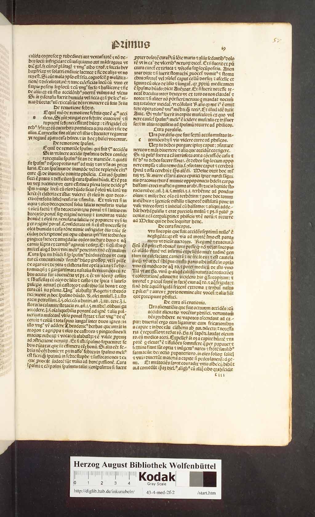 http://diglib.hab.de/inkunabeln/43-4-med-2f-2/00037.jpg