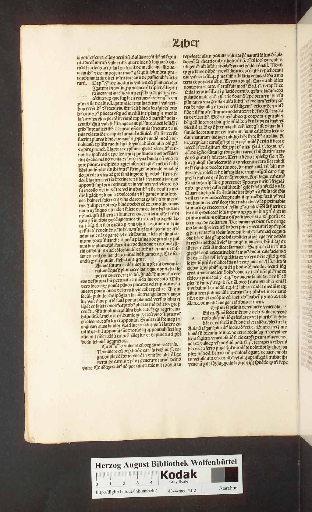 http://diglib.hab.de/inkunabeln/43-4-med-2f-2/00038.jpg