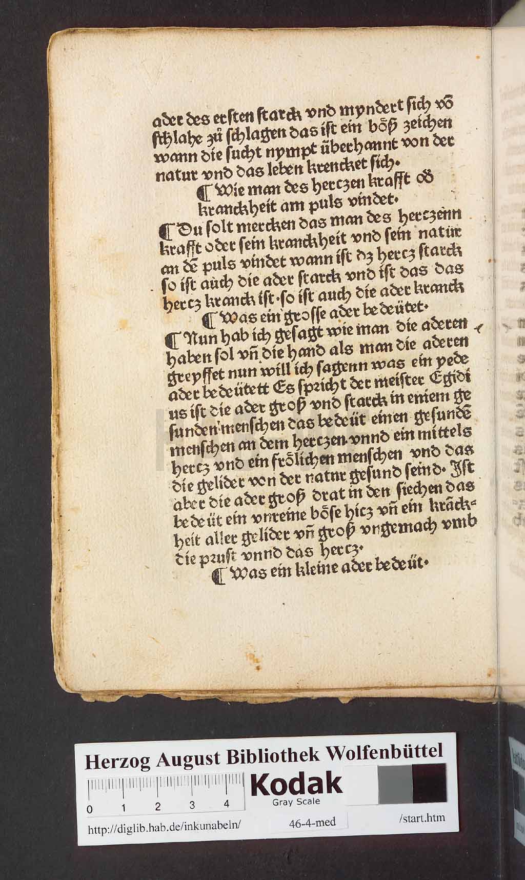 http://diglib.hab.de/inkunabeln/46-4-med/00032.jpg