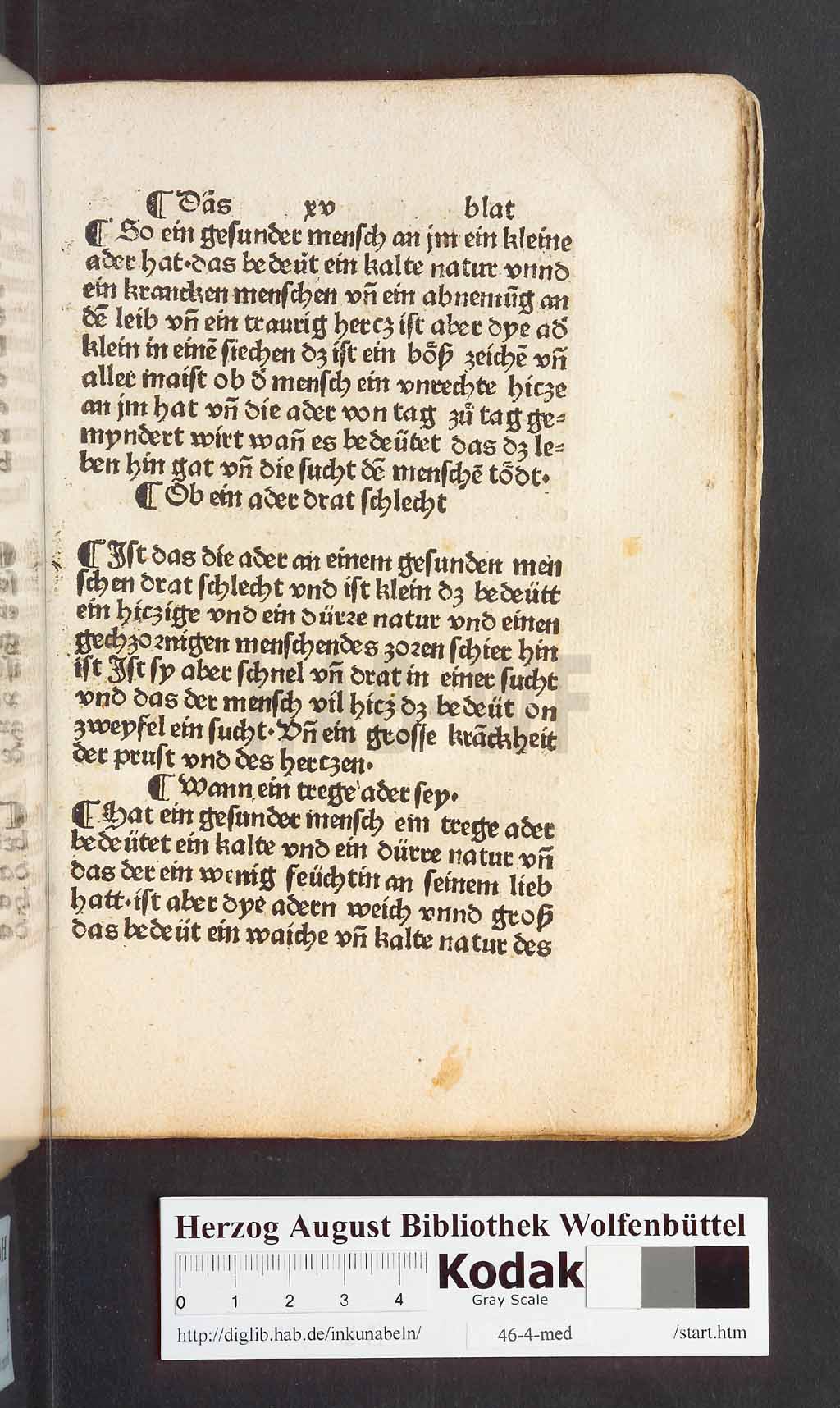 http://diglib.hab.de/inkunabeln/46-4-med/00033.jpg