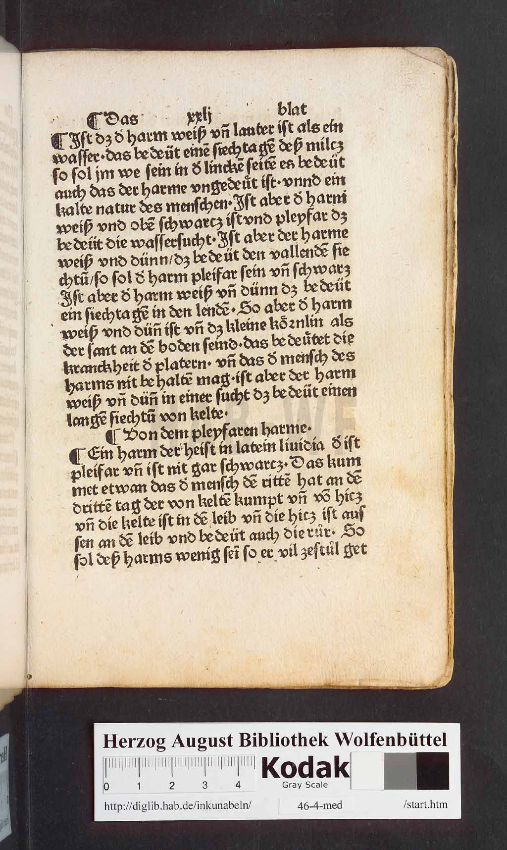 http://diglib.hab.de/inkunabeln/46-4-med/00045.jpg